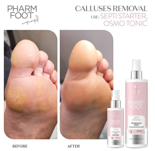 ⁦Pharm Foot | OSMO TONIC ספריי ריכוך רגליים עשיר באוסמוליטים וחומצות אמינו⁩ – תמונה ⁦4⁩