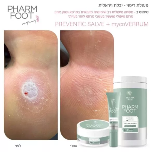 ⁦Herbal reMEDY – מינרלים טיפוליים מועשרים בעשבי מרפא ושמן אוזון | Pharm Foot⁩ – תמונה ⁦3⁩