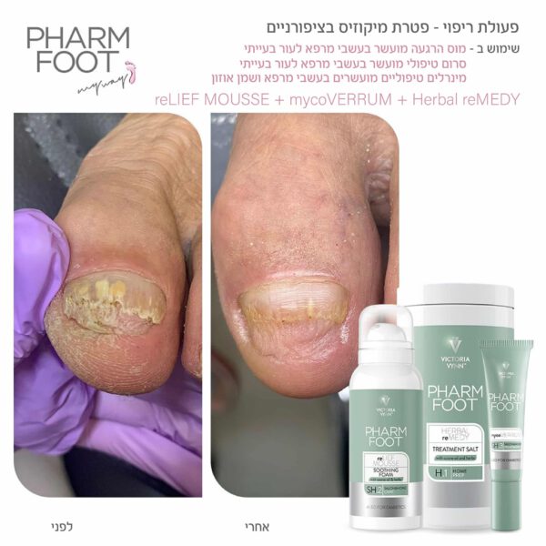 ⁦מוס הרגעה מועשר בעשבי מרפא לעור בעייתי- reLIEF MOUSSE Pharm Foot⁩ – תמונה ⁦4⁩