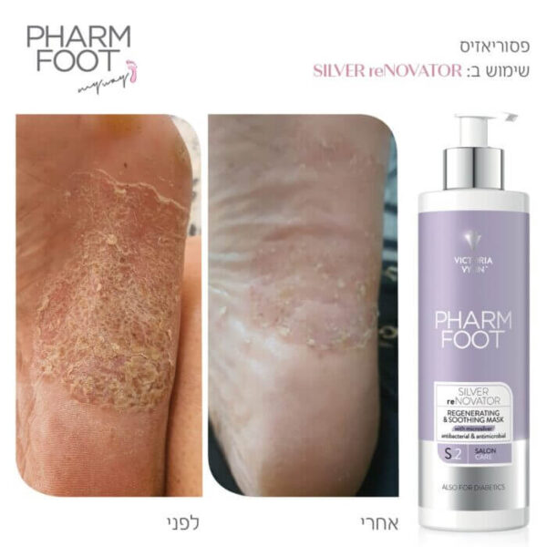 ⁦Pharm Foot | SILVER reNOVATOR מסכת מיקרוסילבר להזנת עור הרגליים Professionals 75ml⁩ – תמונה ⁦2⁩