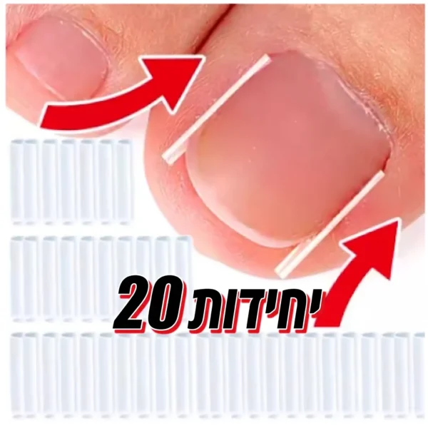 Tamponade – צינוריות סיליקון לתיקון ציפורן חודרנית (טמפונדה רפואית) - 20 יחידות למניעת כאב ויישור הציפורן